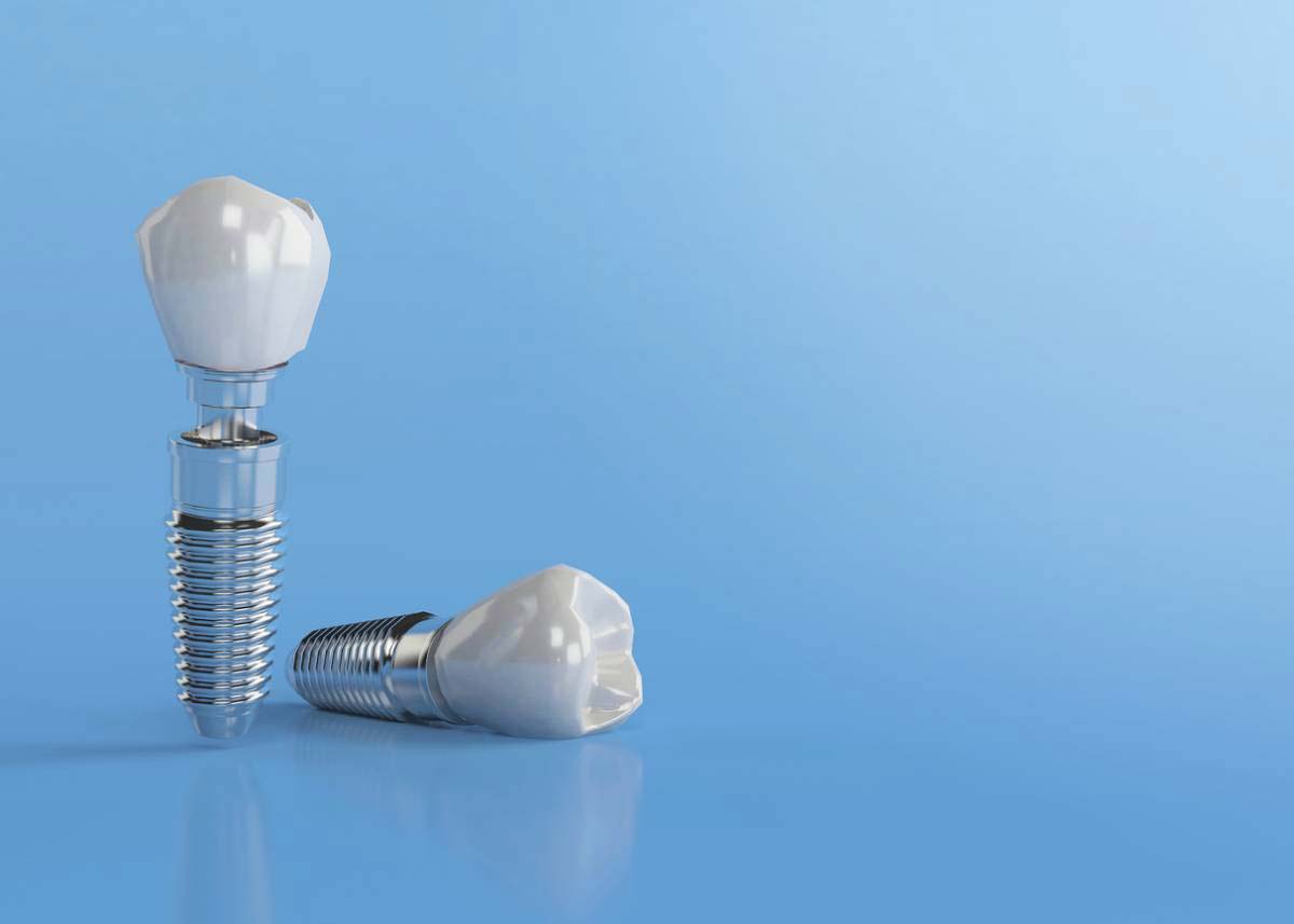 Dental implants can't get cavities.