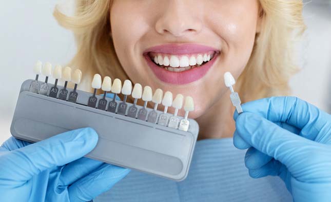 Stock image of Dental crowns checking for matching with patient's teeth color