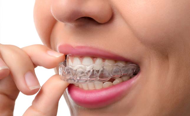 Stock image of a model fixing tranpardnt alignment tray for her teeth
